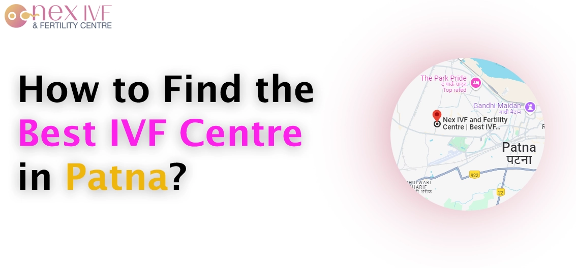 How to Find the Best IVF Centre in Patna?